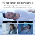 Black anti-snoring mouth tape strips for nasal breathing