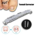 Ingrown toenail corrector kit with brace and precision applicator tool
