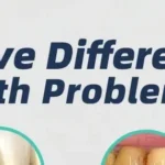 Ultrasonic tooth scaler cleaning teeth with intelligent recognition